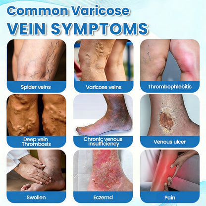 ✨ Alcuras™ Advanced Vein Healing Spray | Fade Varicose & Spider Veins