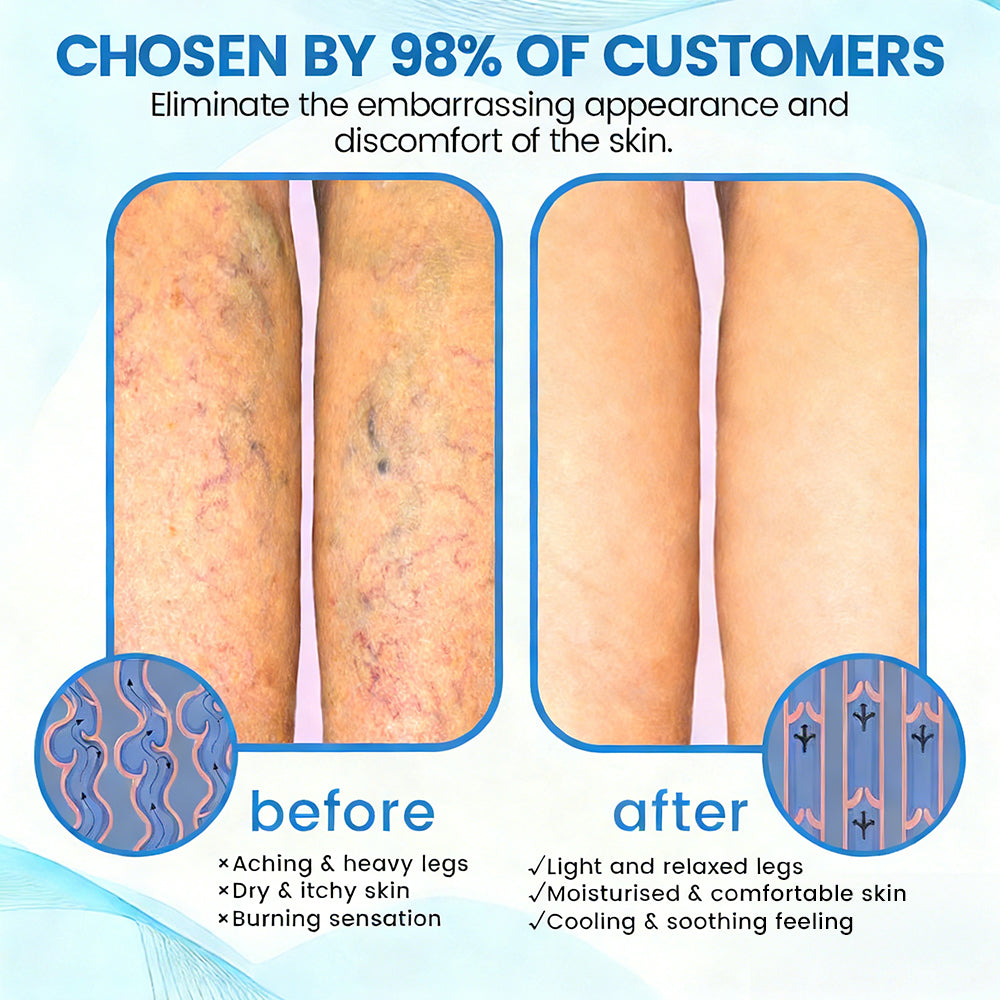 ✨ Alcuras™ Advanced Vein Healing Spray | Fade Varicose & Spider Veins