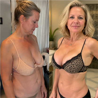 Alcuras® Targeted Breast & Buttock Enhancement Advanced Nano Microneedle Patch