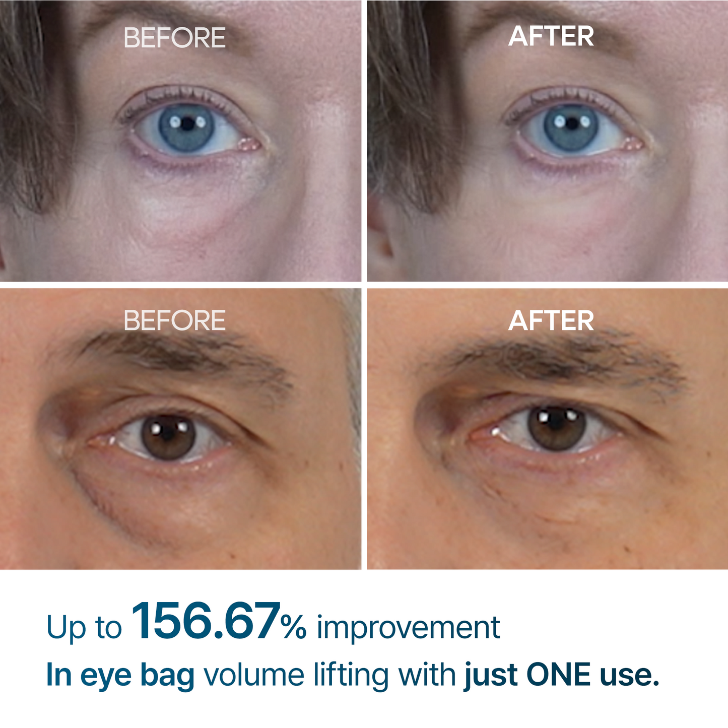 👉 Alcuras™ Advanced Firming Under-Eye Cream | Visibly Lifts Eye Bags & Dark Circles