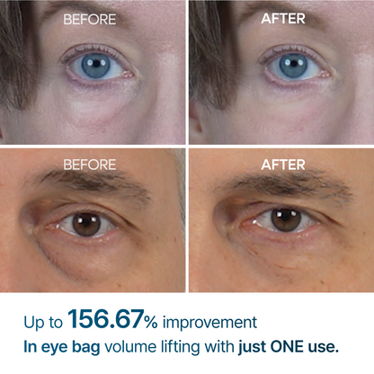 👉 Alcuras™ Advanced Firming Under-Eye Cream | Visibly Lifts Eye Bags & Dark Circles
