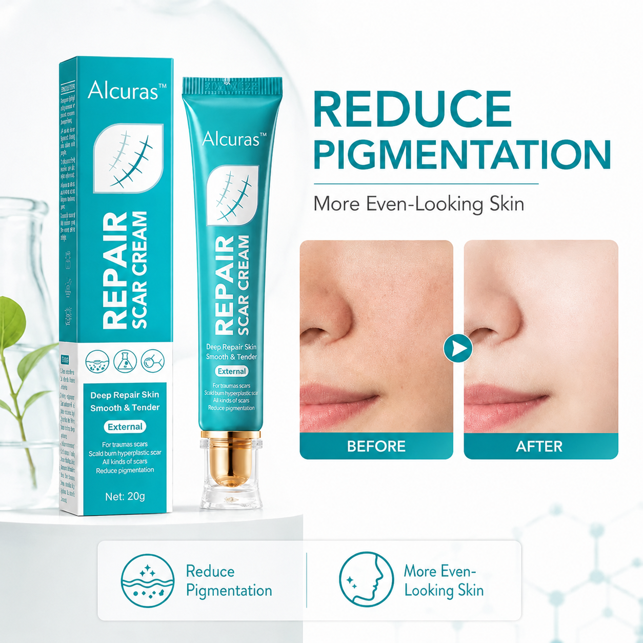 Alcuras™  Deep Repair Scar Cream