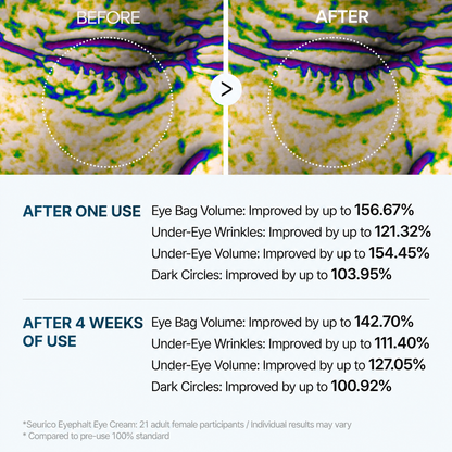 👉 Alcuras™ Advanced Firming Under-Eye Cream | Visibly Lifts Eye Bags & Dark Circles
