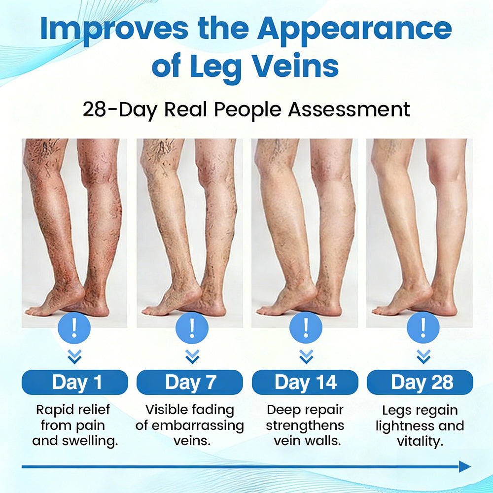 ✨ Alcuras™ Advanced Vein Healing Spray | Fade Varicose & Spider Veins