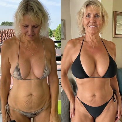Alcuras® Targeted Breast & Buttock Enhancement Advanced Nano Microneedle Patch